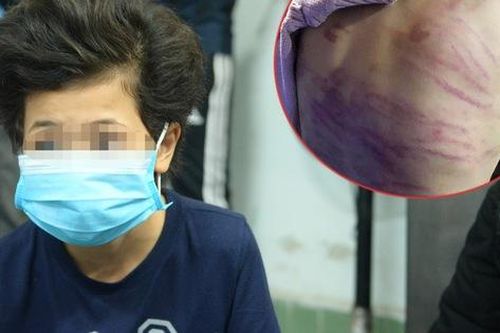 Hà Nội yêu cầu khẩn trương làm rõ vụ bé gái 12 tuổi ở Hà Đông nghi bị mẹ đẻ bạo hành dã man