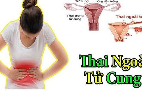 Cô gái 27 tuổi đột ngột lên cơn đau bụng lúc nửa đêm, bác sĩ chỉ định mổ cấp cứu thì thấy bụng bệnh nhân đầy máu