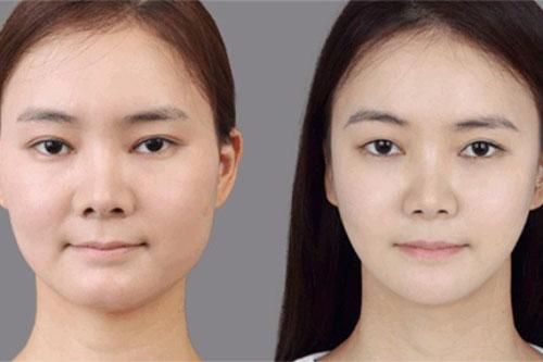 4 cách giảm béo mặt tại nhà bạn phải biết
