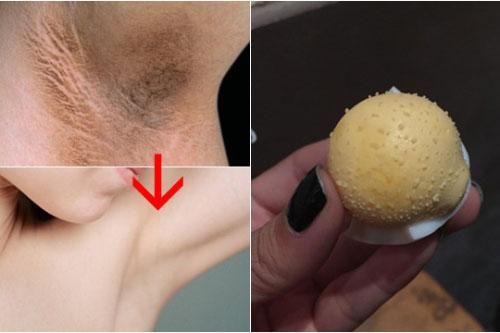 Trị hôi nách vĩnh viễn chỉ bằng trứng gà