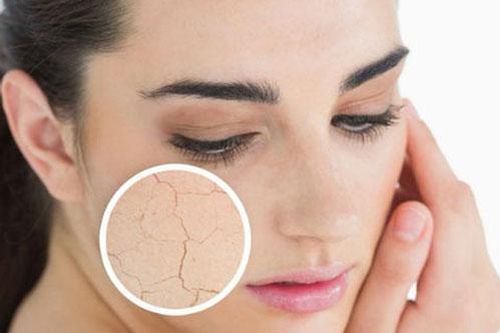 Thực phẩm cần hạn chế ăn nếu không muốn bị khô da