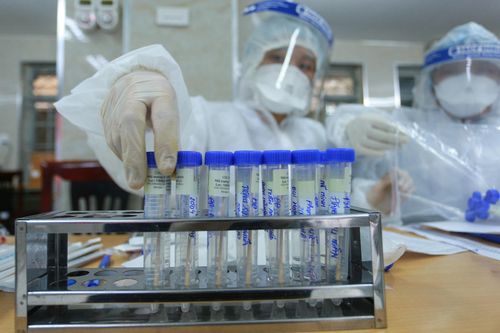 Chuyên gia Nhật Bản tử vong ở Hà Nội nhiễm biến chủng SARS-CoV-2 mới