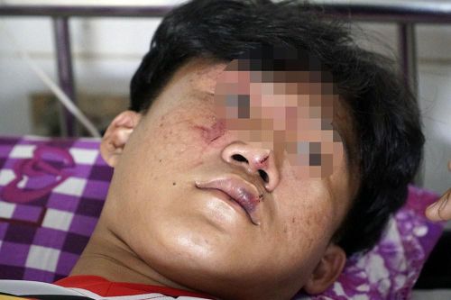Công an điều tra vụ côn đồ vào tận trường bắt, đánh nhiều học sinh