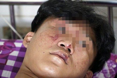 Nhiều học sinh bị nhóm người lạ lôi khỏi trường, đánh văng xuống ruộng