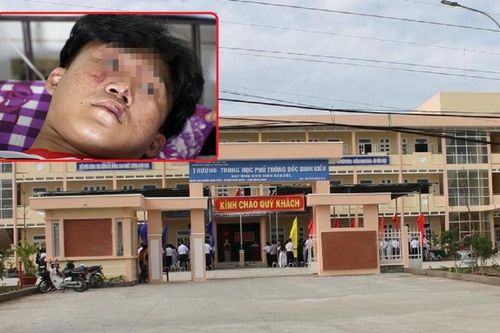 3 học sinh bị nhóm người lạ mặt xông vào trường lôi ra ngoài, đưa đến đường vắng rồi hành hung
