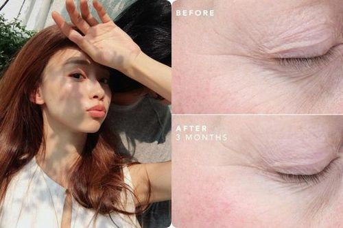 Bác sĩ da liễu chỉ ra điều chị em cần làm trước khi bước vào tuổi U40