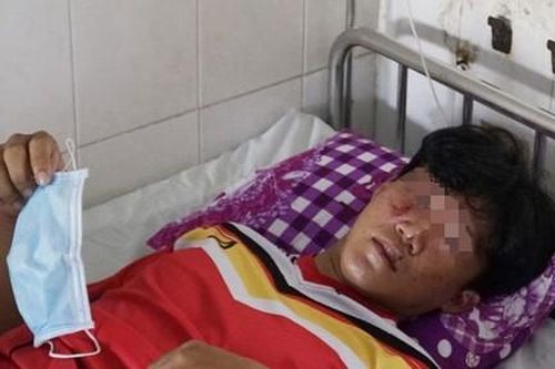3 học sinh của hai trường bị nhóm côn đồ bắt đi, hành hung gây thương tích