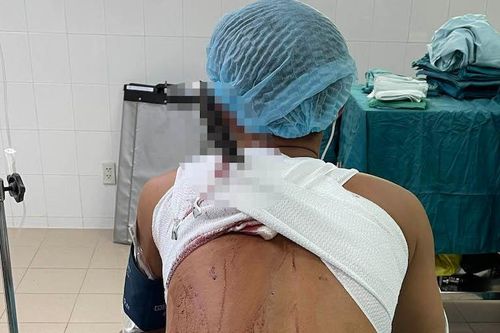 Nam thanh niên bị đâm thấu lưng sau tiệc nhậu