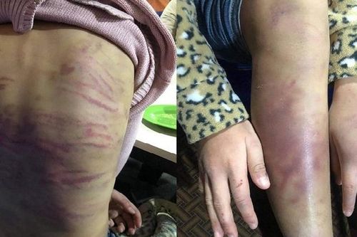Cháu bé 12 tuổi ở Hà Nội bị bạo hành: 'Lỗ hổng' pháp lý trong việc bảo vệ trẻ em