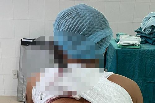 Đang nhậu đòi về, nhóm thanh niên chém nhau dao dính chặt ở lưng