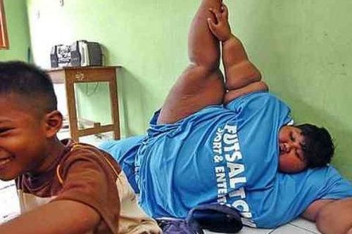 Cậu bé béo nhất thế giới giảm hơn nửa trọng lượng sau 3 năm