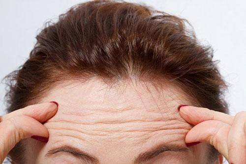 Bạn đã biết tại sao trán lại nhiều nếp nhăn?