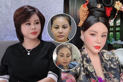 Lê Giang vui vẻ dù bị chê xấu: Phẫu thuật thẩm mỹ để mình hoàn hảo hơn, đẹp rồi thì chẳng cần phải sửa