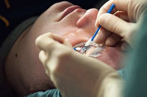 Nên mổ mắt cận vào thời điểm nào?