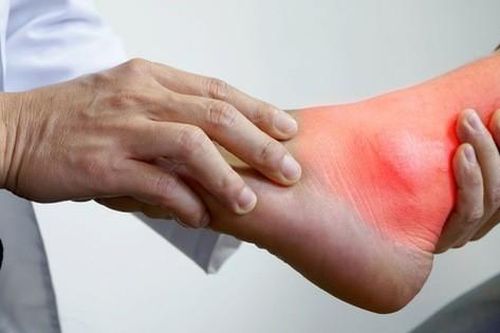 Bệnh lý đặc biệt sau Tết hay gặp dễ nhầm với bệnh lý xương khớp, chủ quan có thể dẫn tới tàn phế