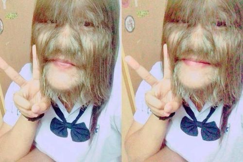 Diện mạo mới gây kinh ngạc của cô gái từng bị gọi là 'người sói', bị kỳ thị 10 năm vì căn bệnh hiếm gặp