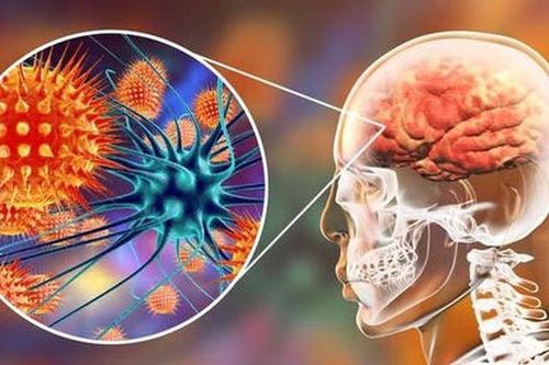 Cảnh báo virus làm phù não có nguy cơ gây chết người cao gấp 75 lần COVID-19