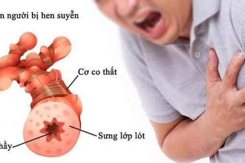 Làm gì khi bị chít hẹp phế quản?