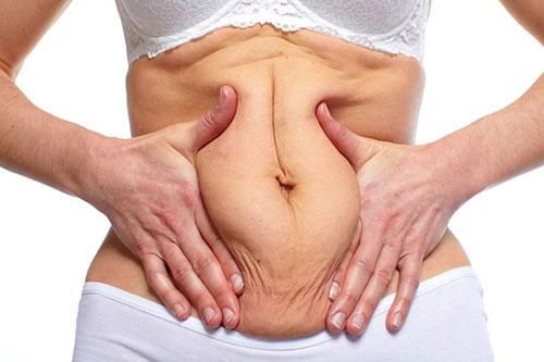 3 bước cải thiện vùng da bụng chảy xệ