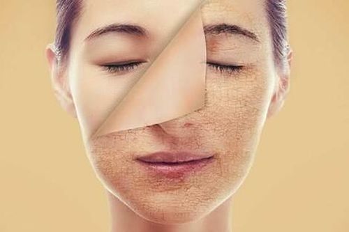Lão hóa da và các vấn đề thường gặp