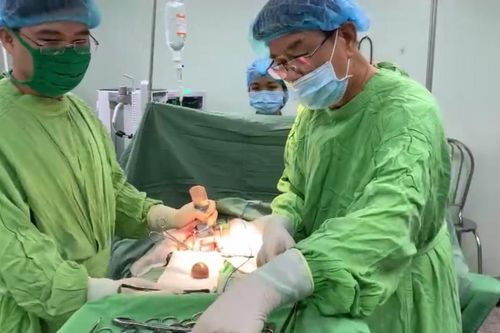 Mổ thành công sỏi bàng quang là ống sonde bỏ quên 9 năm trong cơ thể