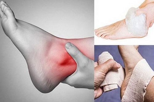 Các bước sơ cứu khi bị trật khớp chân