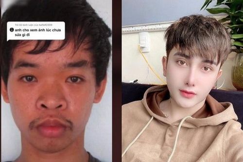 Thẩm mỹ 9 lần do xin việc thất bại, nam thanh niên Việt 'lột xác thành người khác' lên báo nước ngoài