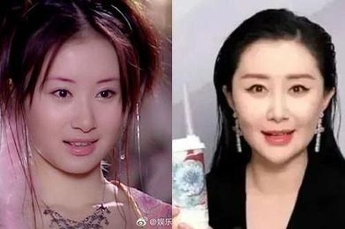 Mỹ nhân 'Thiên long bát bộ' gây tiếc nuối vì gương mặt thay đổi