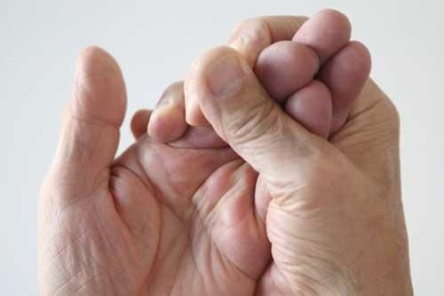 10 triệu chứng tê tay báo hiệu bệnh nguy hiểm