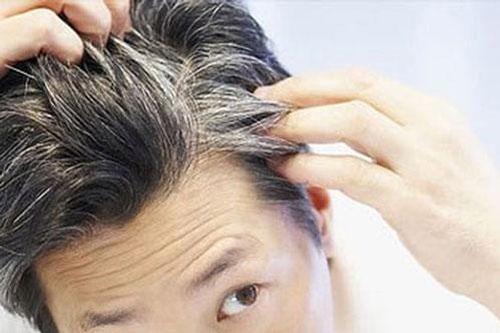 Vì sao tóc bạc sớm?