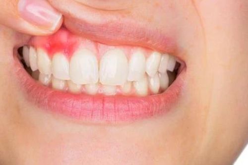 5 hiện tượng cho thấy bạn đang già đi, phương pháp giúp làm chậm quá trình lão hóa
