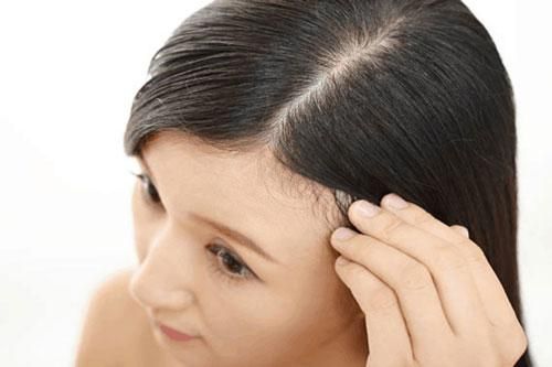 Xử lý tóc bết dính đơn giản hơn bạn nghĩ