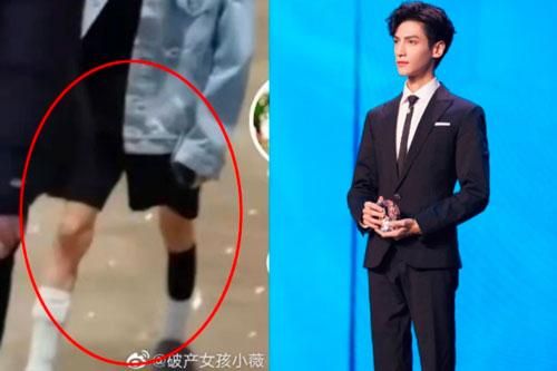 Mỹ nam 'Hương Mật Tựa Khói Sương' La Vân Hi khiến công chúng phát hoảng với đôi chân gầy tong teo