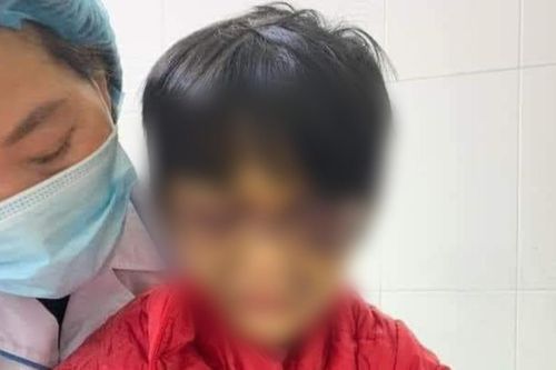 Hải Dương: Mẹ đẻ nhốt con gái 6 tuổi vào phòng, đánh đập dã man vì thường xuyên đi vệ sinh không bảo mẹ
