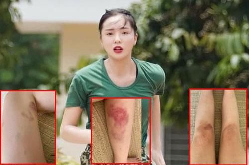 Fans xót xa khi chứng kiến đôi chân te tua, bầm dập của Hoa hậu Kỳ Duyên sau khi tham gia 'Sao nhập ngũ'