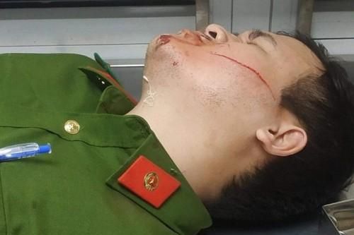 Đà Nẵng: Hai chiến sĩ công an bị chém khi đang làm nhiệm vụ