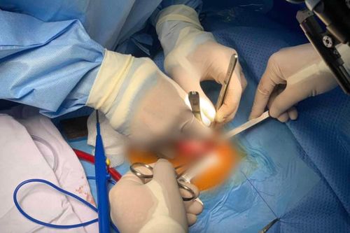 Bác sĩ 'bắt' tim ngừng đập để hồi sinh sự sống cho bé 5 tháng tuổi