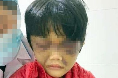 Hội LHPN Hải Dương thông tin chi tiết vụ mẹ bạo hành con gái 6 tuổi ở huyện Cẩm Giàng