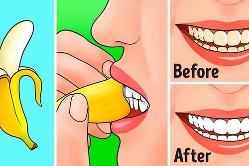 10 mẹo vặt 'thần thánh' từ vỏ chuối rất ít người biết