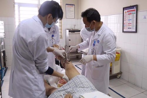 Dập nát cẳng chân do tai nạn lao động