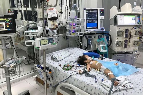 Bé gái 15 tháng tuổi bị biến chứng nặng do mắc bệnh tay chân miệng