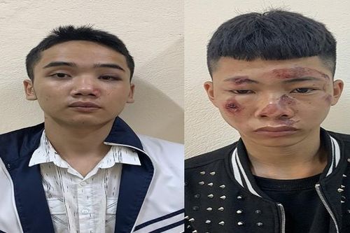 Chiến sĩ CSGT bị người vi phạm tông gãy tay chân