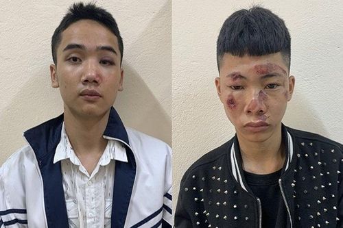 Tạm giữ nam thanh niên tông gãy chân, tay Cảnh sát giao thông