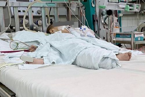 Một bé trai 13 tháng tuổi nguy kịch do uống nhầm dầu thắp đèn