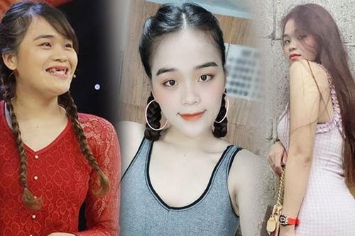 Ngân Thảo: Từ cô gái mất 9 cái răng 'lột xác' thành mỹ nữ gợi cảm