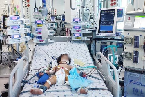 Bé gái 15 tháng tuổi mắc tay chân miệng biến chứng