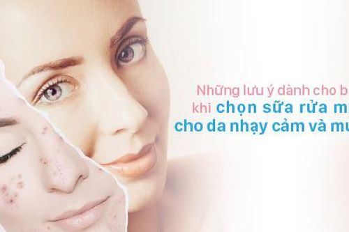 Những lưu ý khi chọn sữa rửa mặt cho da nhạy cảm và mụn