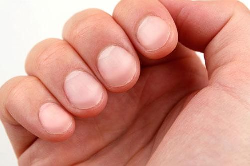 Xòe lòng bàn tay và nắm chặt, nếu thấy có dấu hiệu này cần đi khám ngay
