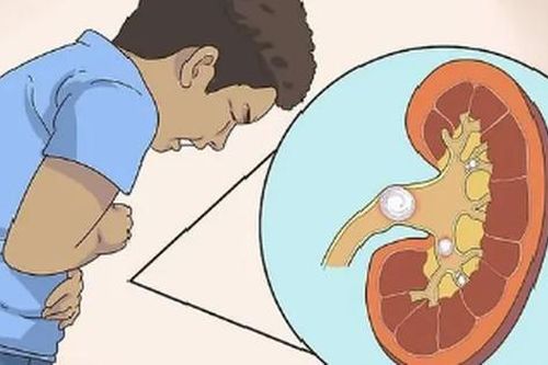Từ vụ bé 11 tuổi phát hiện hội chứng thận hư sau khi sưng mắt kéo dài, bác sĩ cảnh báo dấu hiệu cần khám sớm