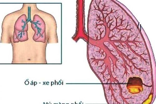 Hoa phù dung thanh nhiệt, giải độc